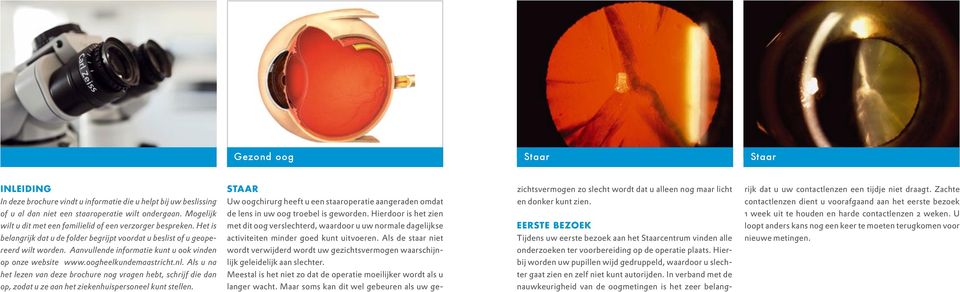 contactlenzen dient u voorafgaand aan het eerste bezoek of u al dan niet een staaroperatie wilt ondergaan. Mogelijk de lens in uw oog troebel is geworden.