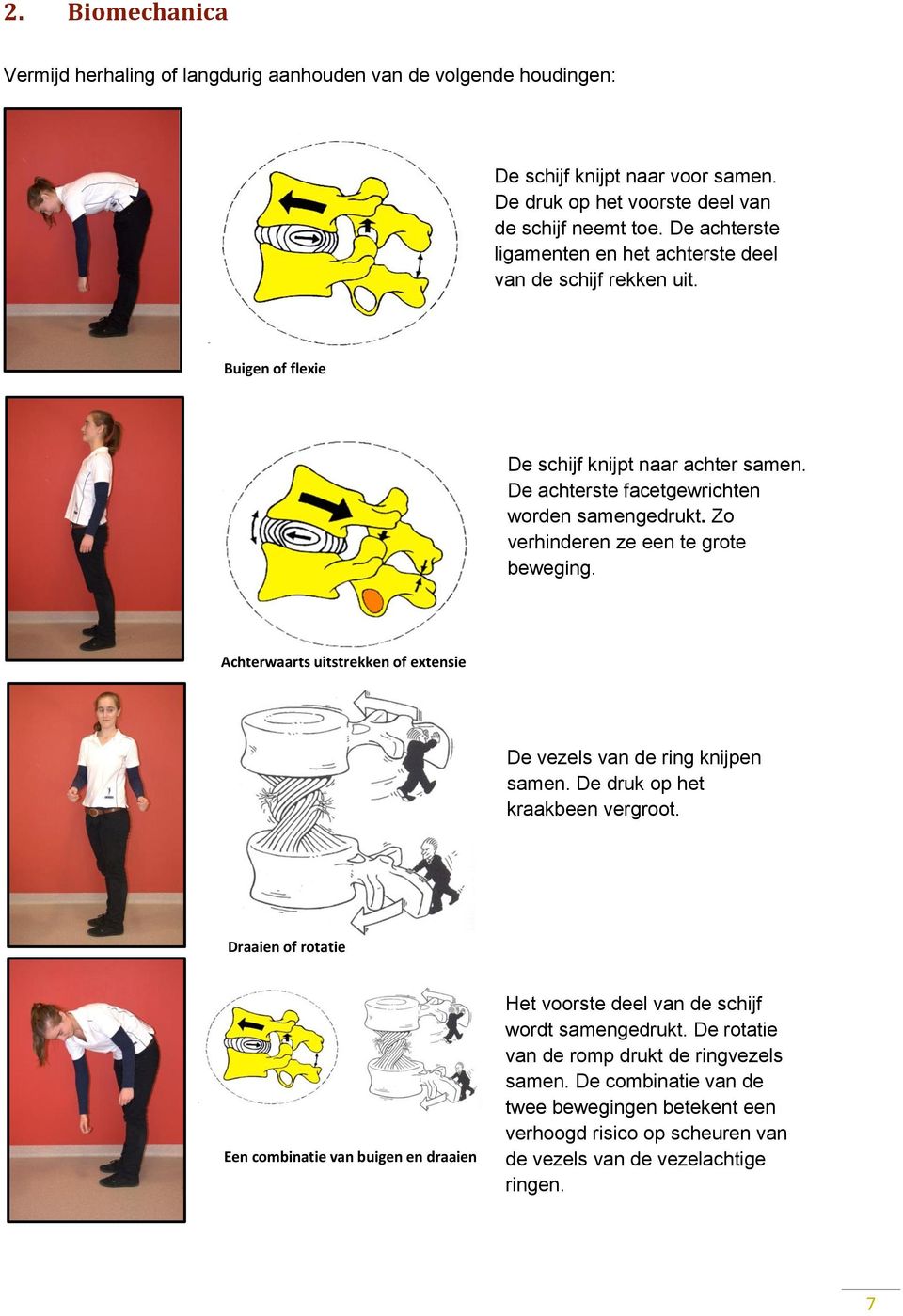 Zo verhinderen ze een te grote beweging. Achterwaarts uitstrekken of extensie De vezels van de ring knijpen samen. De druk op het kraakbeen vergroot.