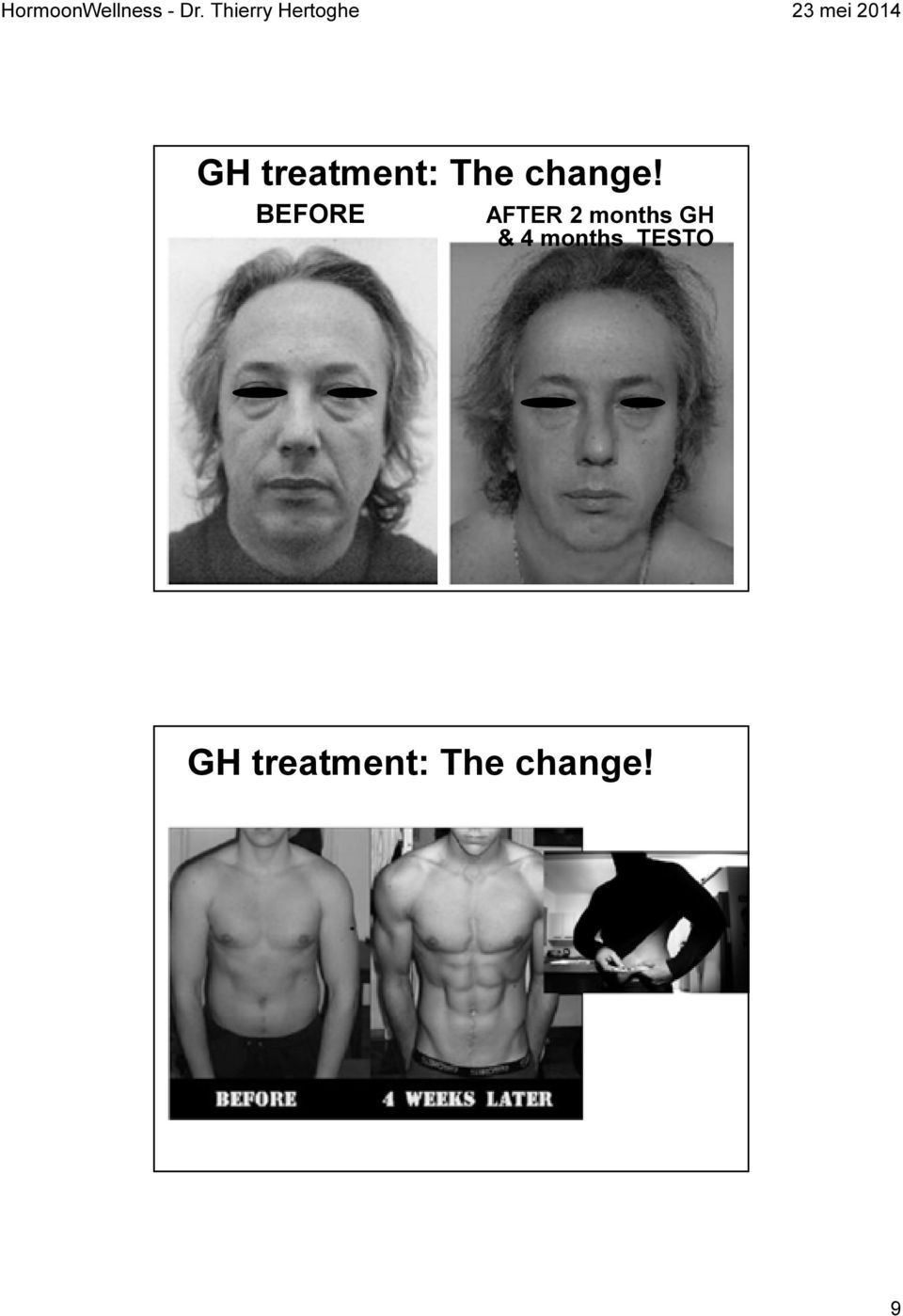 treatment: The change!