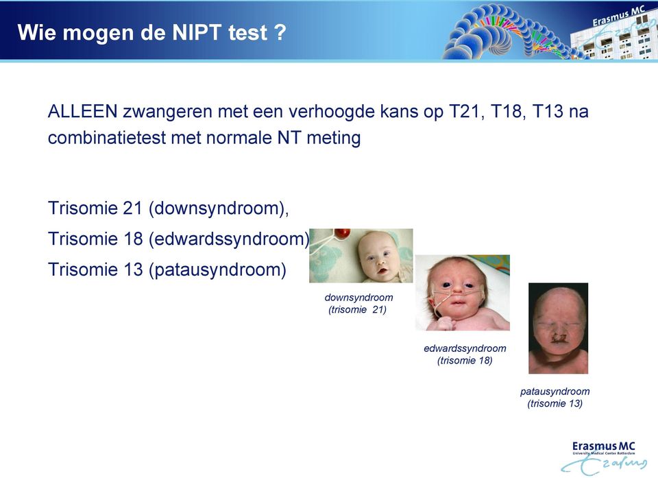 combinatietest met normale NT meting Trisomie 21 (downsyndroom),