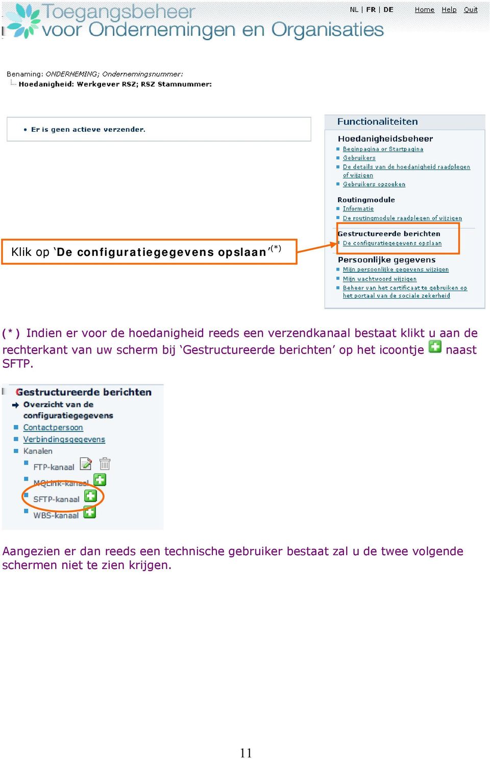 Gestructureerde berichten op het icoontje naast SFTP.