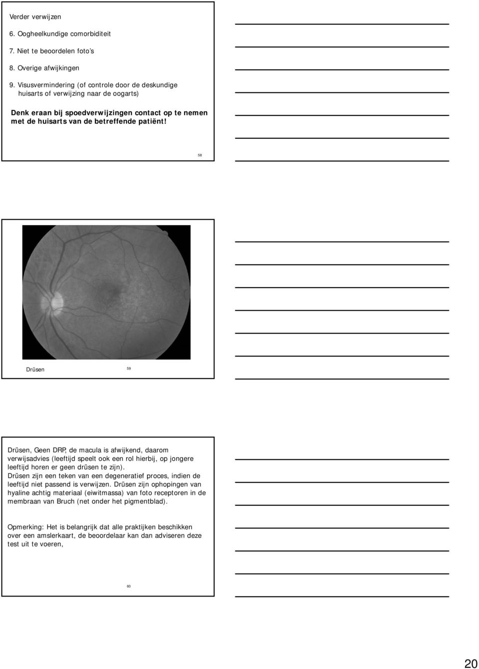 58 Drüsen 59 Drüsen, Geen DRP, de macula is afwijkend, daarom verwijsadvies (leeftijd speelt ook een rol hierbij, op jongere leeftijd horen er geen drüsen te zijn).