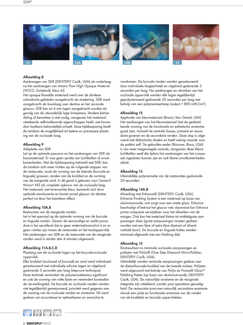 SDR kan tot 4 mm lagen aangebracht worden als gevolg van de uitzonderlijk lage krimpstress.