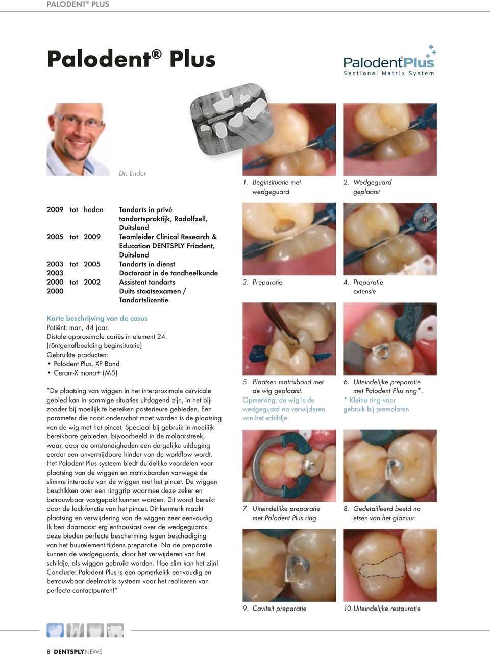 2003 Doctoraat in de tandheelkunde 2000 tot 2002 Assistent tandarts 2000 Duits staatsexamen / Tandartslicentie Korte beschrijving van de casus Patiënt: man, 44 jaar.