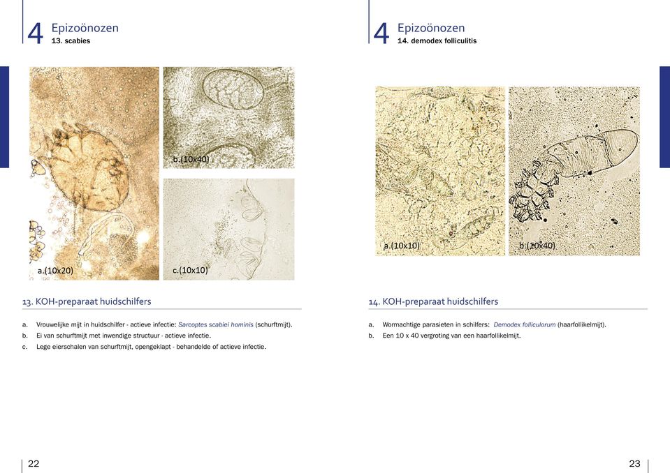 b. Ei van schurftmijt met inwendige structuur - actieve infectie. b. Een 10 40 vergroting van een haarfollikelmijt. c.