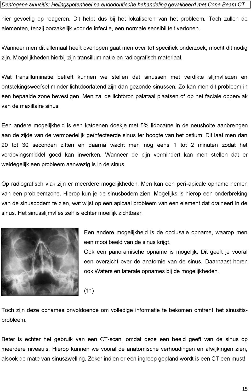 Wat transilluminatie betreft kunnen we stellen dat sinussen met verdikte slijmvliezen en ontstekingsweefsel minder lichtdoorlatend zijn dan gezonde sinussen.