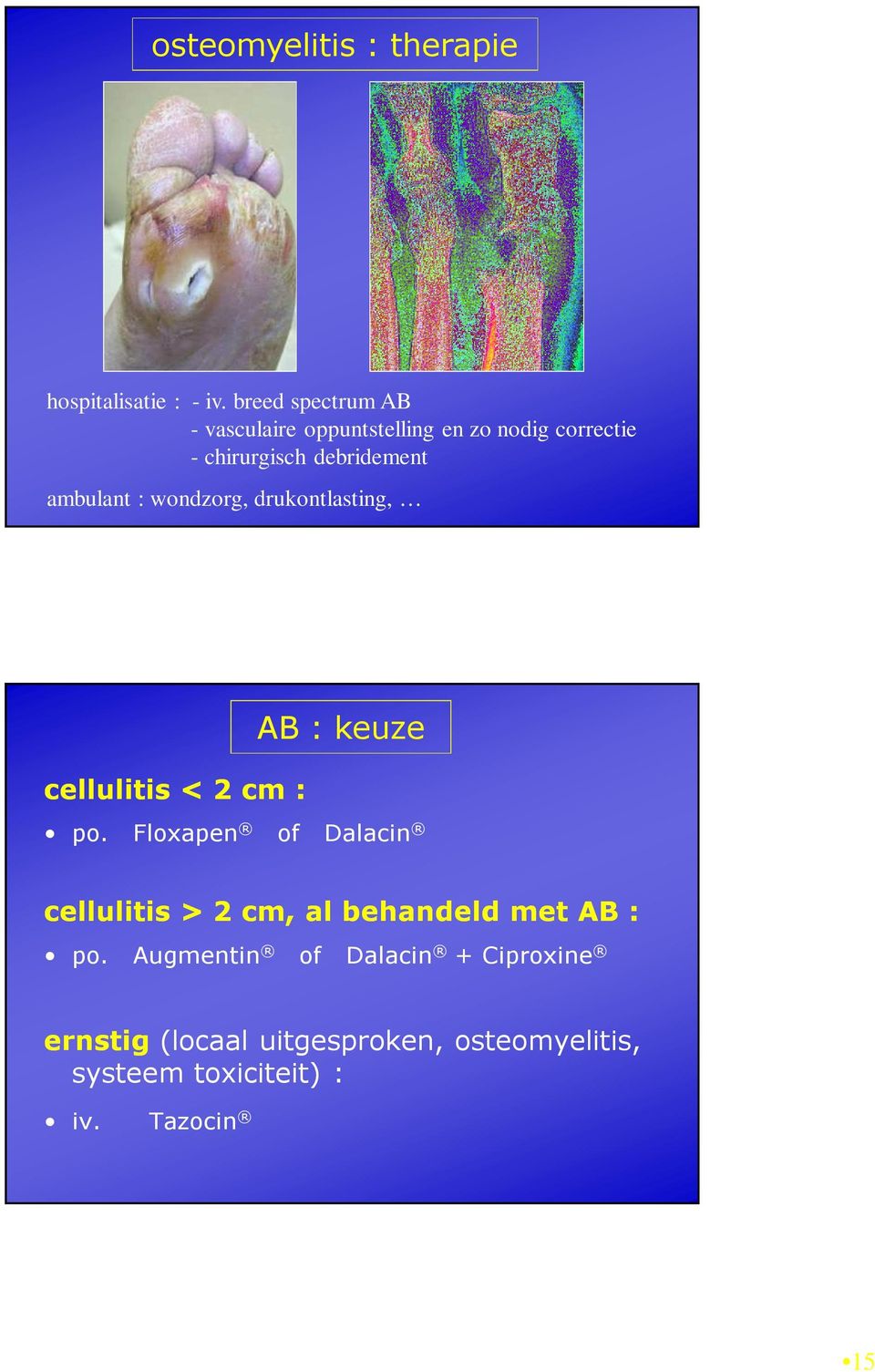 ambulant : wondzorg, drukontlasting, cellulitis < 2 cm : AB : keuze po.