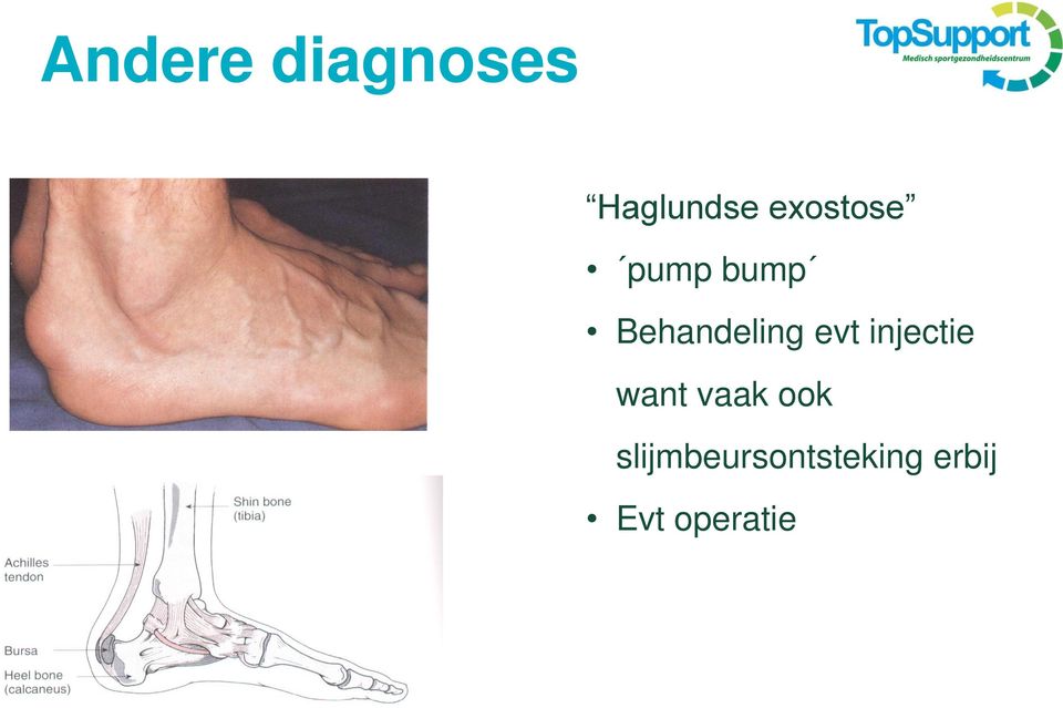 evt injectie want vaak ook