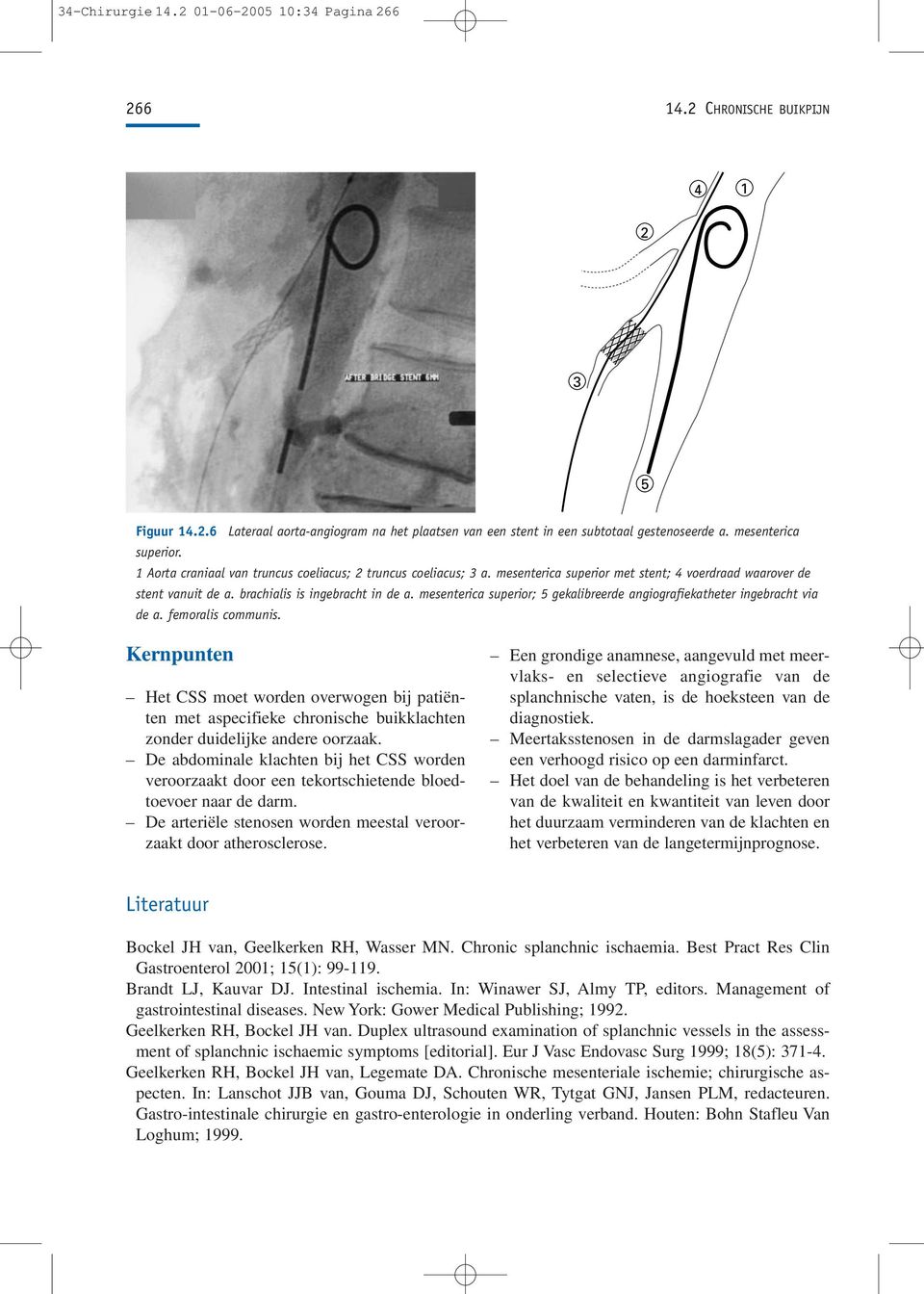 mesenterica superior; 5 gekalibreerde angiografiekatheter ingebracht via de a. femoralis communis.