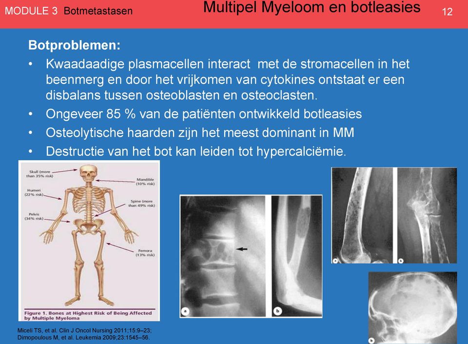 Ongeveer 85 % van de patiënten ontwikkeld botleasies Osteolytische haarden zijn het meest dominant in MM Destructie