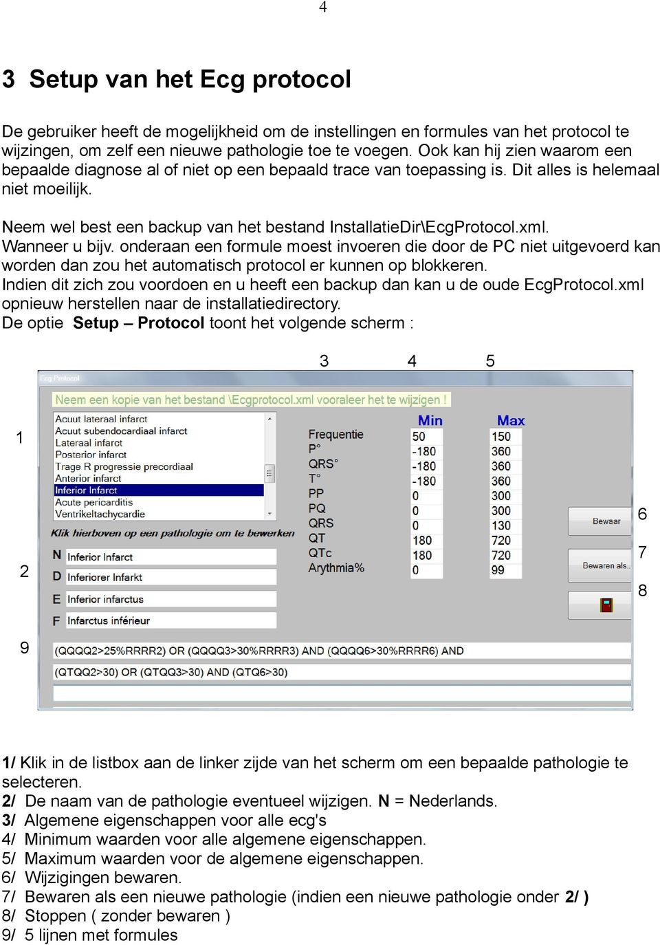 Neem wel best een backup van het bestand InstallatieDir\EcgProtocol.xml. Wanneer u bijv.