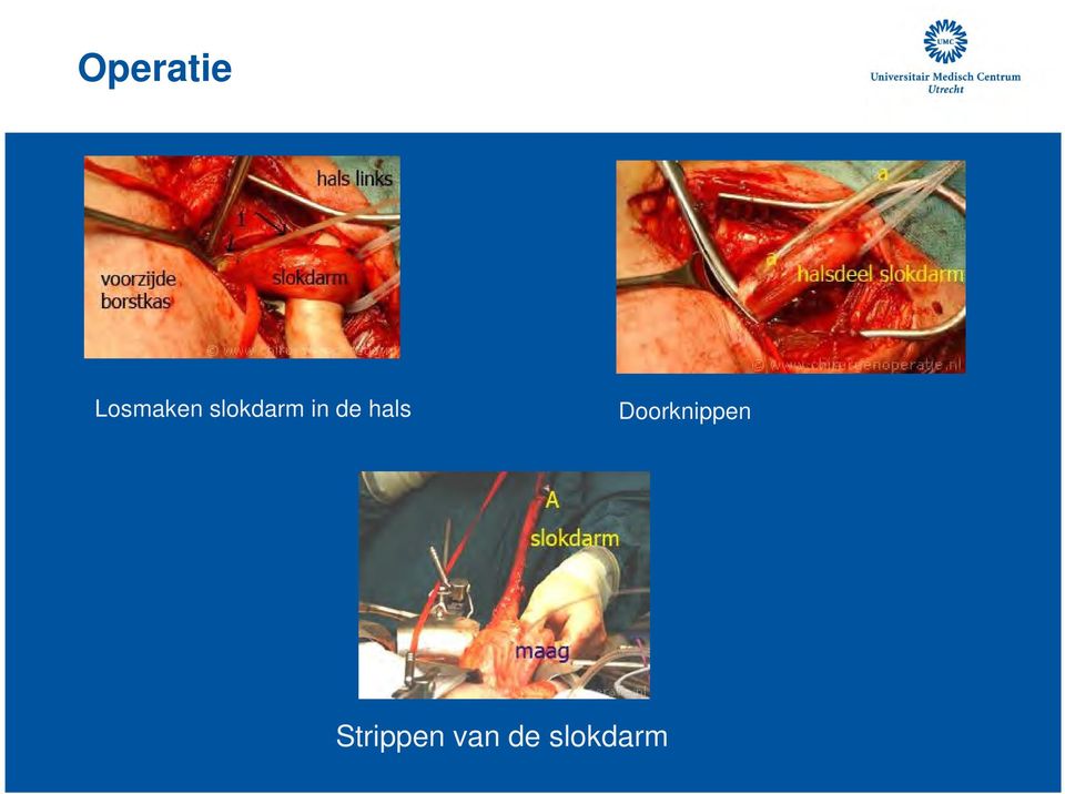 Doorknippen  Strippen