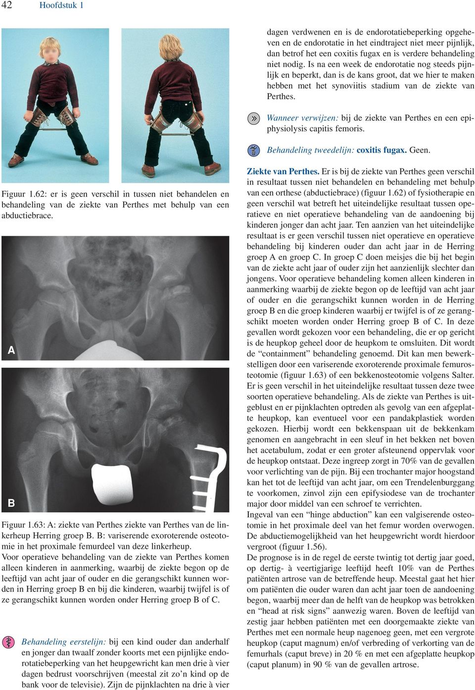 Wanneer verwijzen: bij de ziekte van Perthes en een epiphysiolysis capitis femoris. ehandeling tweedelijn: coxitis fugax. Geen. Figuur 1.