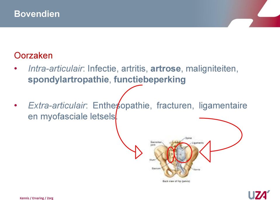 spondylartropathie, functiebeperking