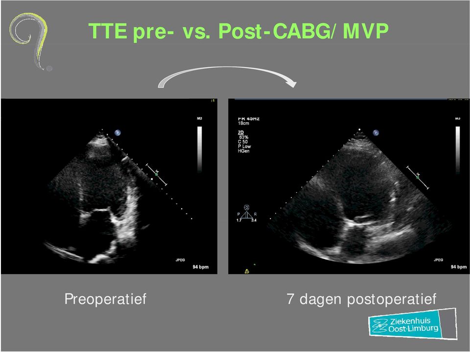 Preoperatief 7