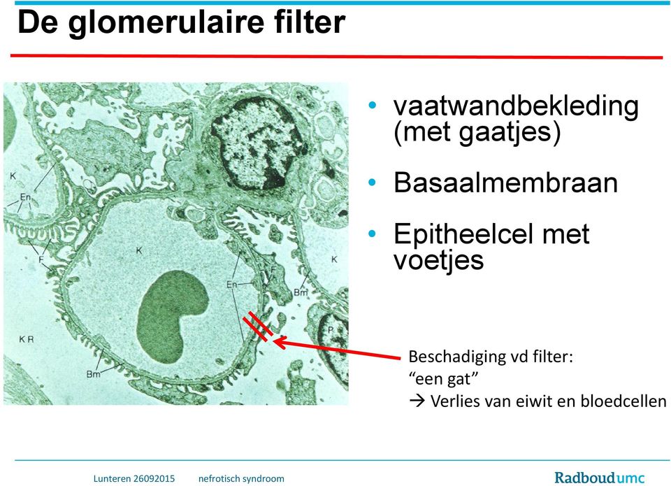 Basaalmembraan Epitheelcel met voetjes