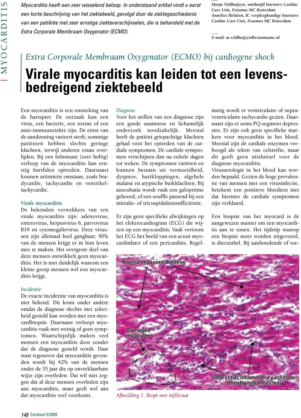 Extra Corporale Membraam Oxygenator (ECMO).