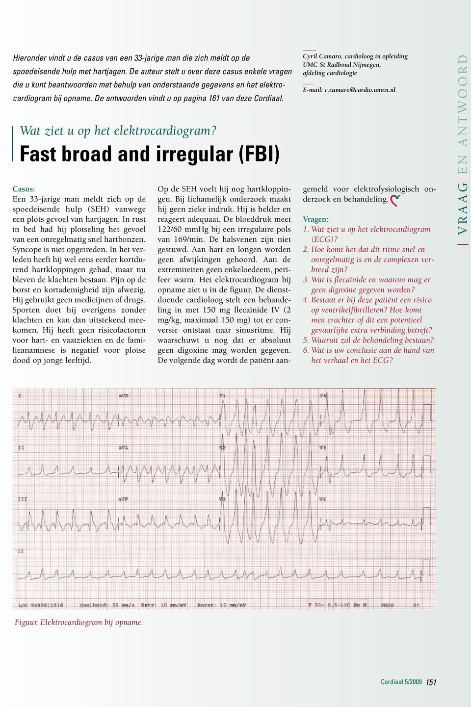 Wat ziet u op het elektrocardiogram? Fast broad and irregular (FBI) Casus: Een 33-jarige man meldt zich op de spoedeisende hulp (SEH) vanwege een plots gevoel van hartjagen.