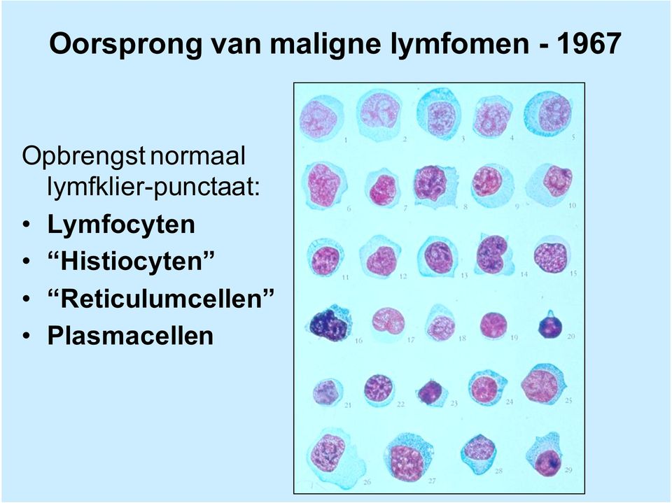 lymfklier-punctaat: Lymfocyten