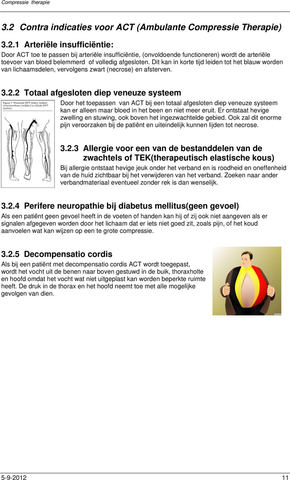 2 Totaal afgesloten diep veneuze systeem Door het toepassen van ACT bij een totaal afgesloten diep veneuze systeem kan er alleen maar bloed in het been en niet meer eruit.