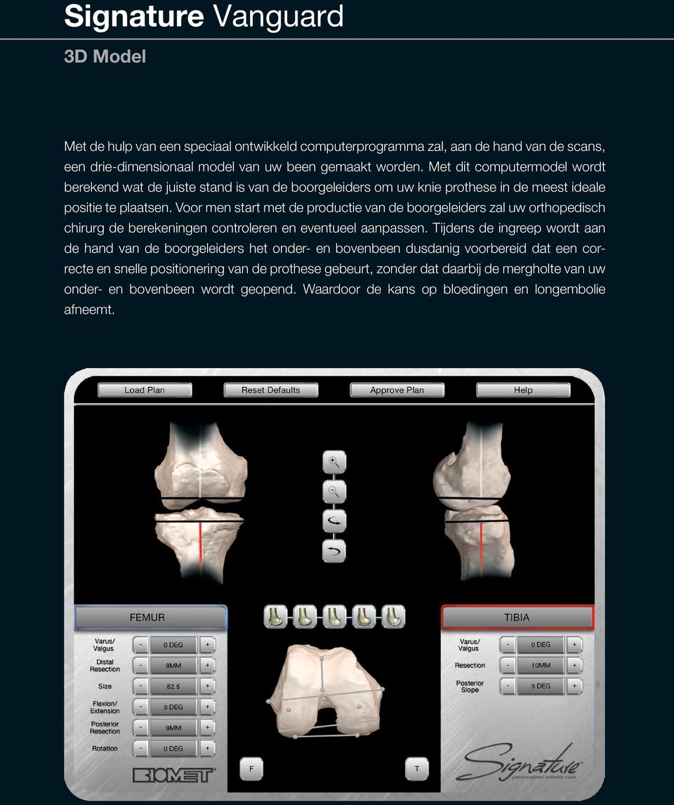 Voor men start met de productie van de boorgeleiders zal uw orthopedisch chirurg de berekeningen controleren en eventueel aanpassen.