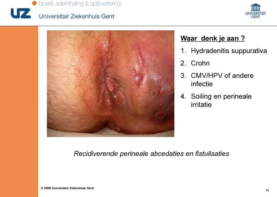 CMV/HPV of andere infectie 4.