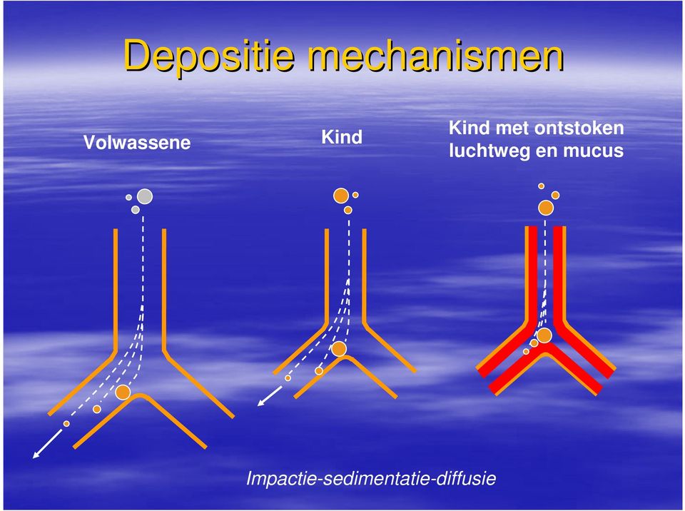 ontstoken luchtweg en