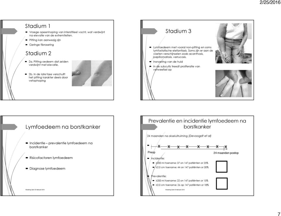 Lymfoedeem met vooral non-pitting en soms lymfostatische elefantiasis. Soms zijn er aan de voeten verschijnselen zoals acanthosis, papillomatosis, verrucosis.! Insnoering van de huid!