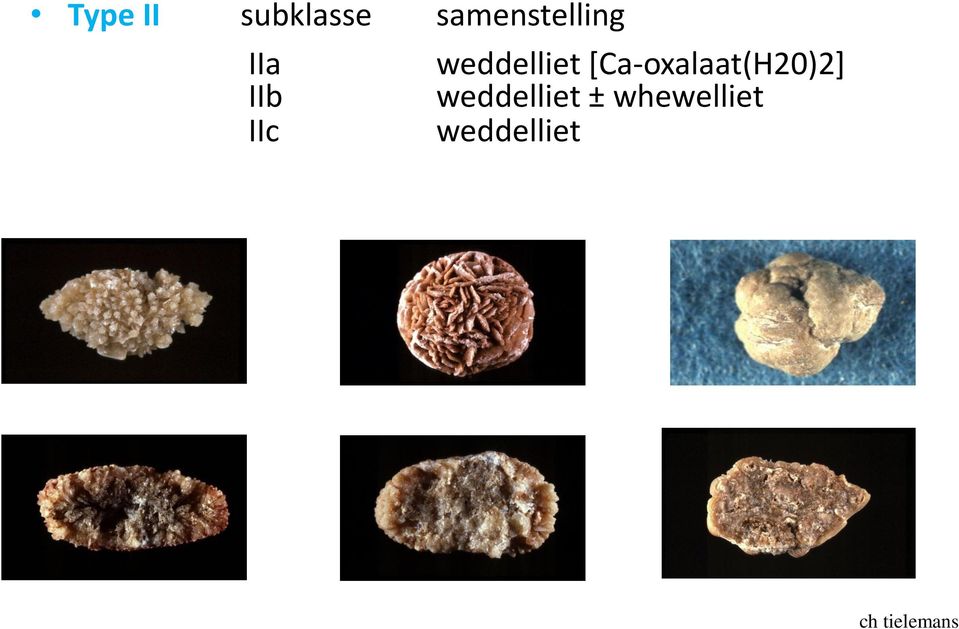 weddelliet [Ca-oxalaat(H20)2]