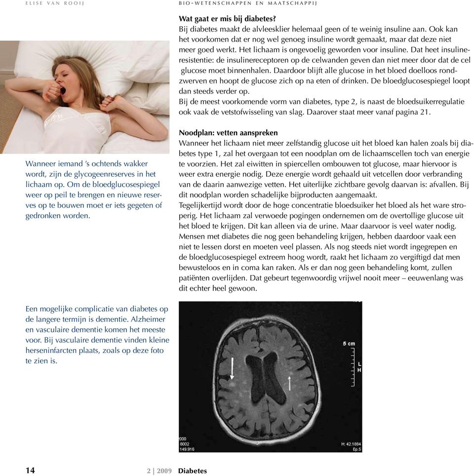 Dat heet insulineresistentie: de insulinereceptoren op de celwanden geven dan niet meer door dat de cel glucose moet binnenhalen.