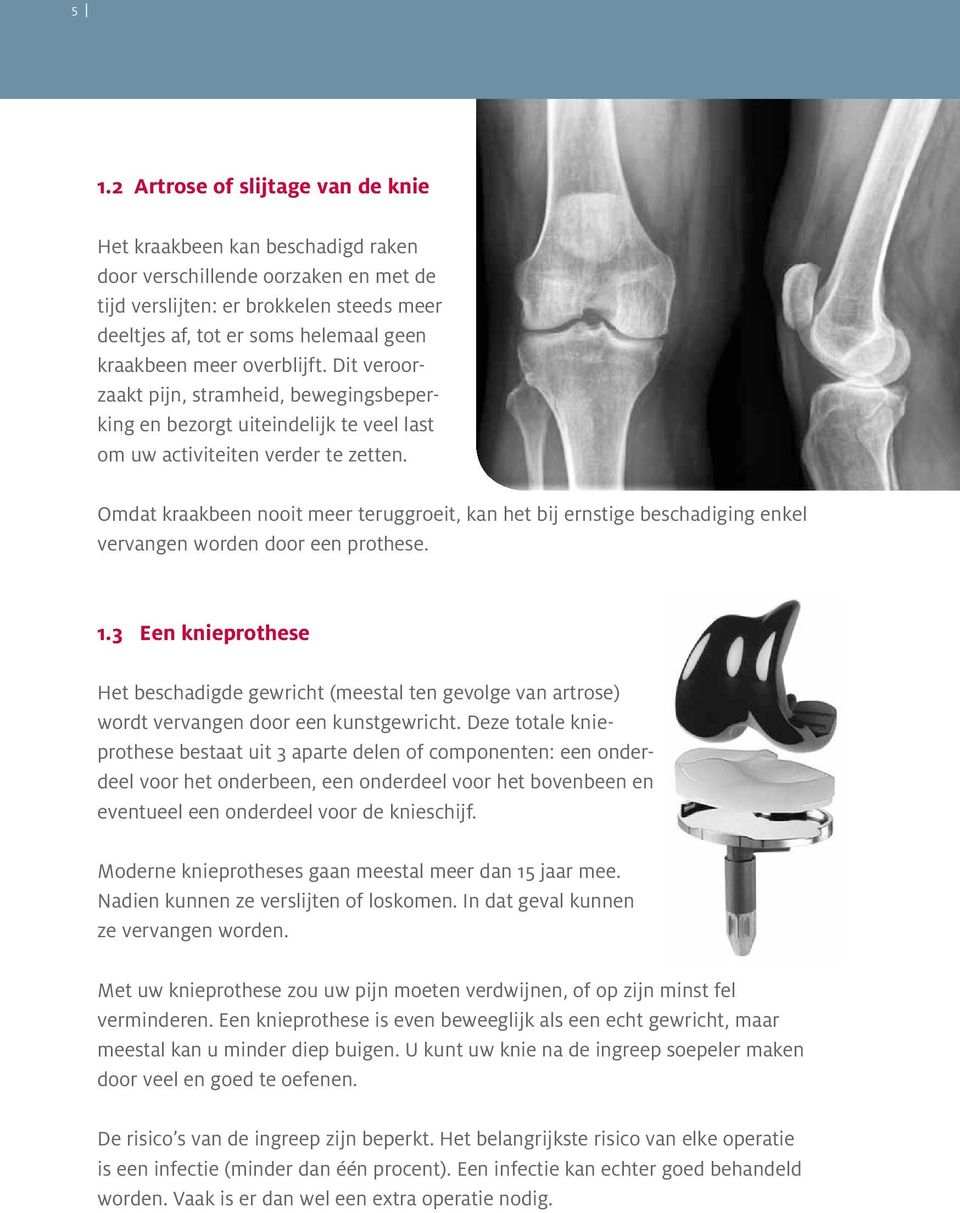 Omdat kraakbeen nooit meer teruggroeit, kan het bij ernstige beschadiging enkel vervangen worden door een prothese. 1.