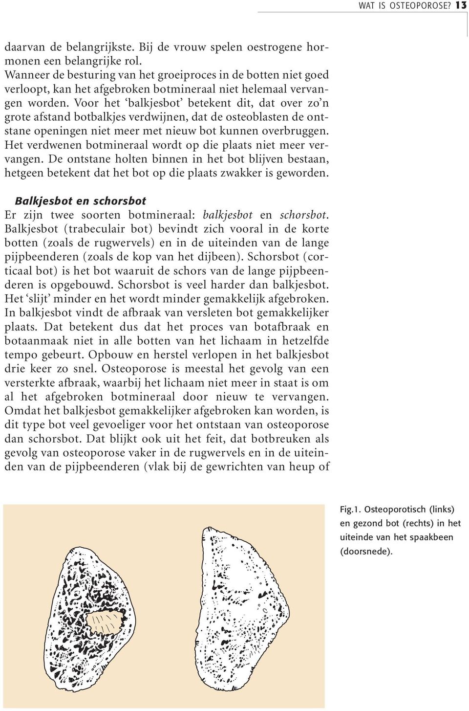 Voor het balkjesbot betekent dit, dat over zo n grote afstand botbalkjes verdwijnen, dat de osteoblasten de ontstane openingen niet meer met nieuw bot kunnen overbruggen.