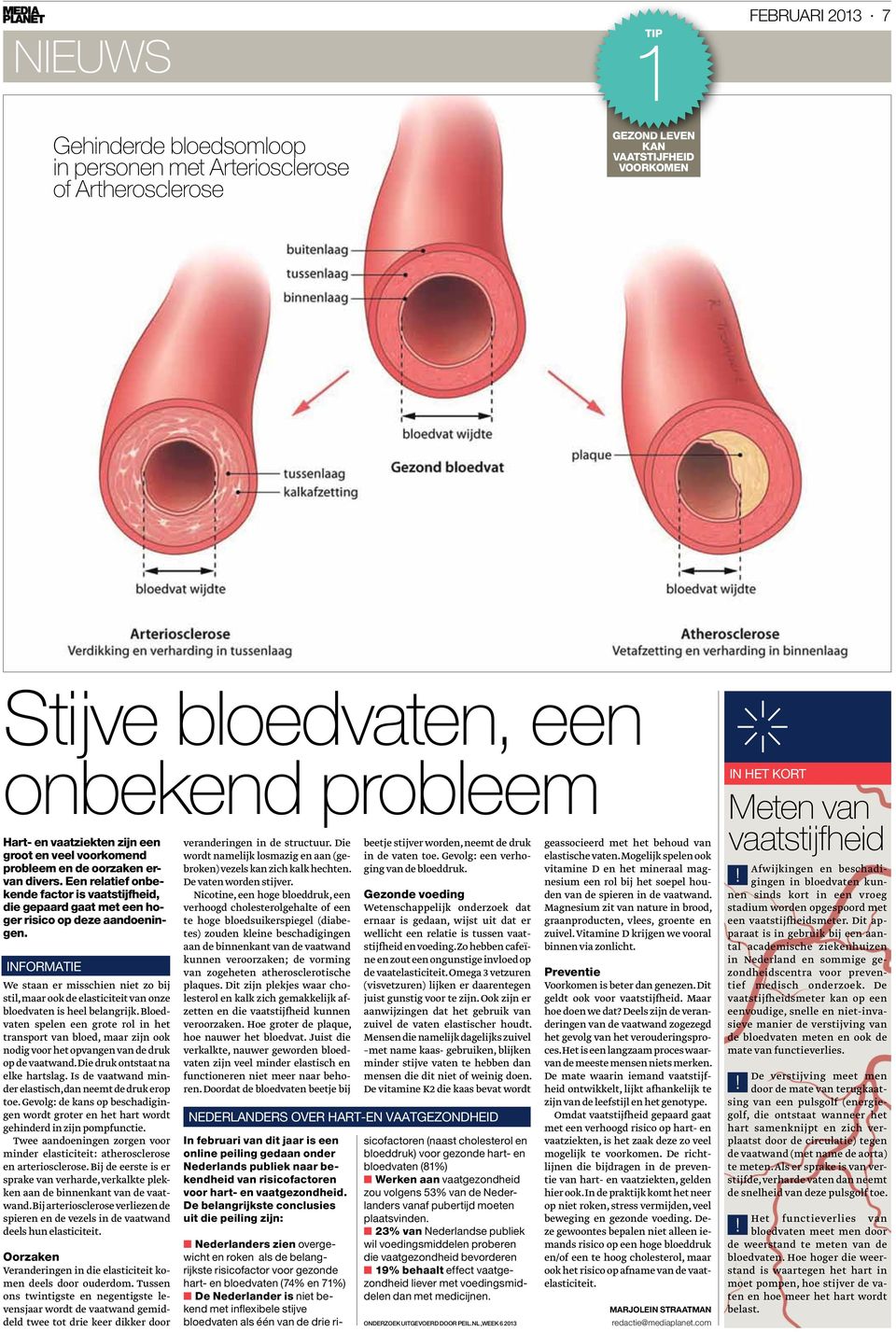 informatie We staan er misschien niet zo bij stil, maar ook de elasticiteit van onze bloedvaten is heel belangrijk.