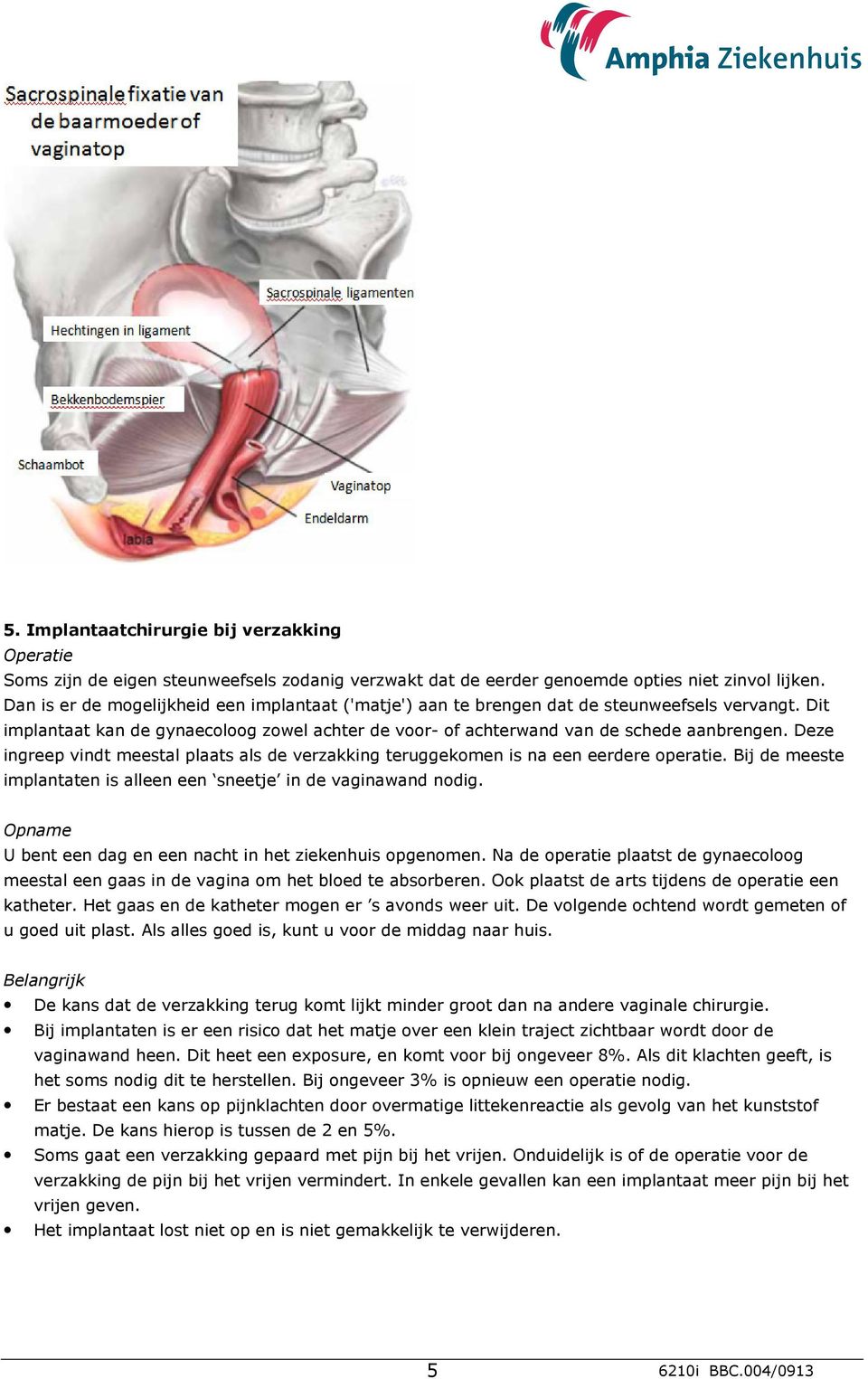 Deze ingreep vindt meestal plaats als de verzakking teruggekomen is na een eerdere operatie. Bij de meeste implantaten is alleen een sneetje in de vaginawand nodig.