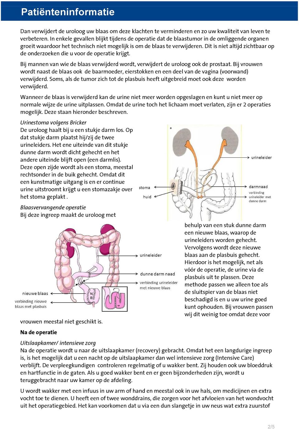 Dit is niet altijd zichtbaar op de onderzoeken die u voor de operatie krijgt. Bij mannen van wie de blaas verwijderd wordt, verwijdert de uroloog ook de prostaat.