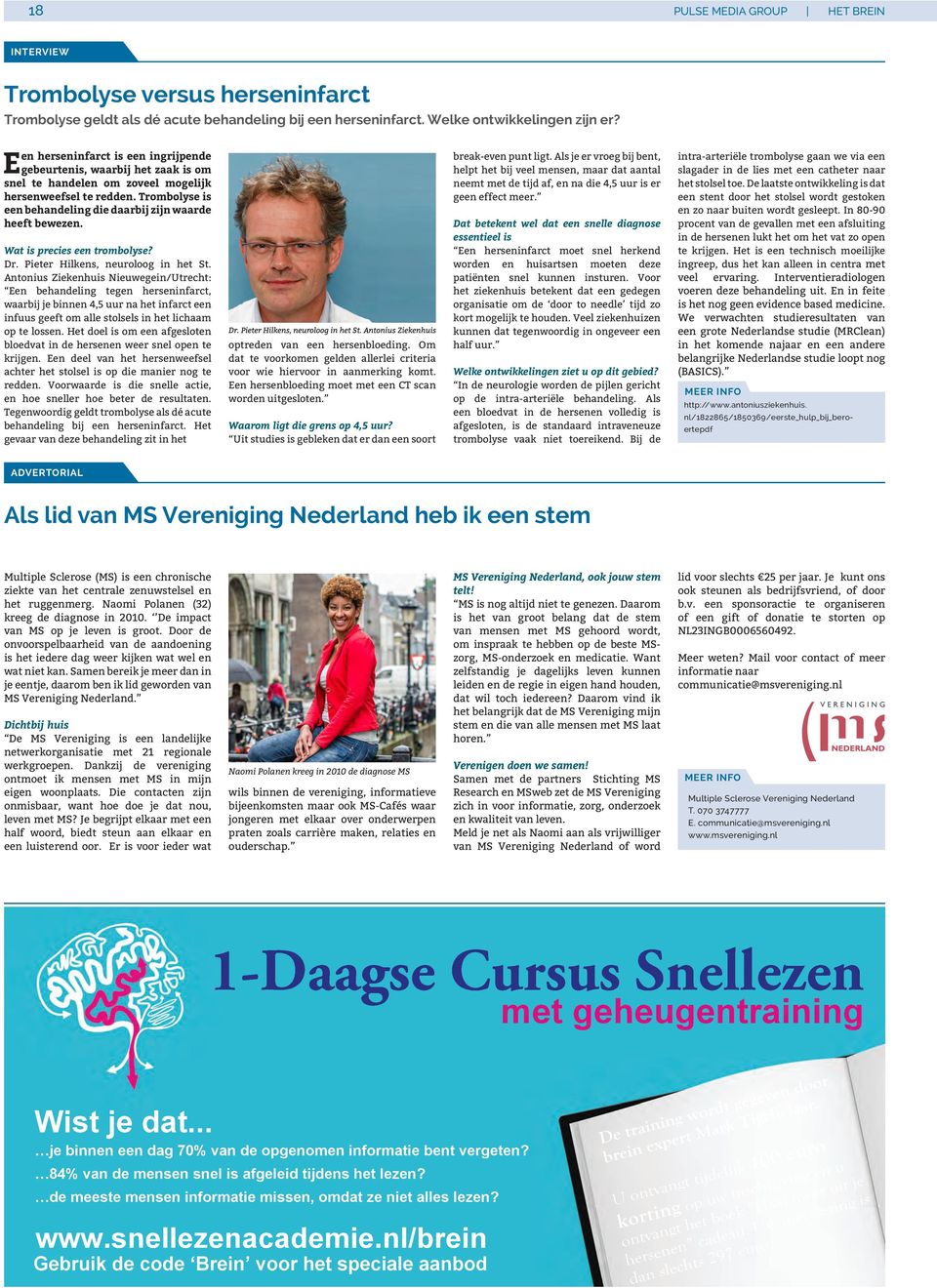 Trombolyse is een behandeling die daarbij zijn waarde heeft bewezen. Wat is precies een trombolyse? Dr. Pieter Hilkens, neuroloog in het St.