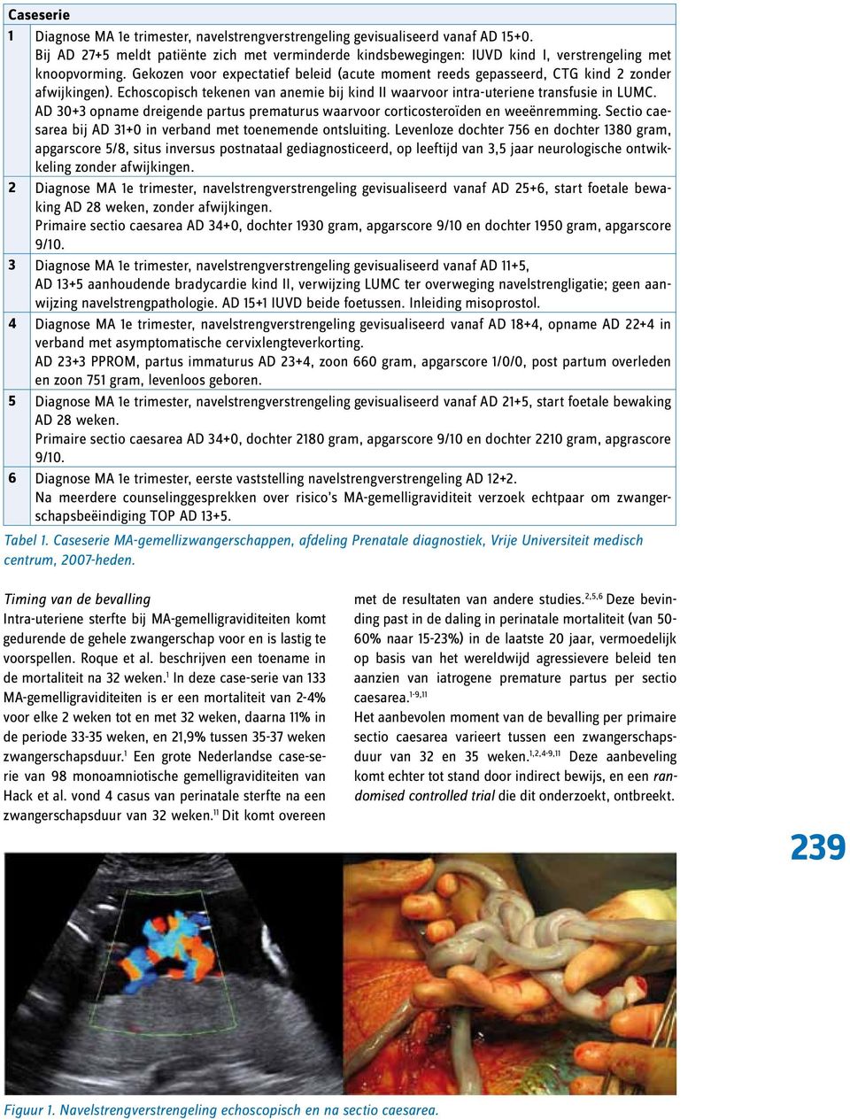 Gekozen voor expectatief beleid (acute moment reeds gepasseerd, CTG kind 2 zonder afwijkingen). Echoscopisch tekenen van anemie bij kind II waarvoor intra-uteriene transfusie in LUMC.