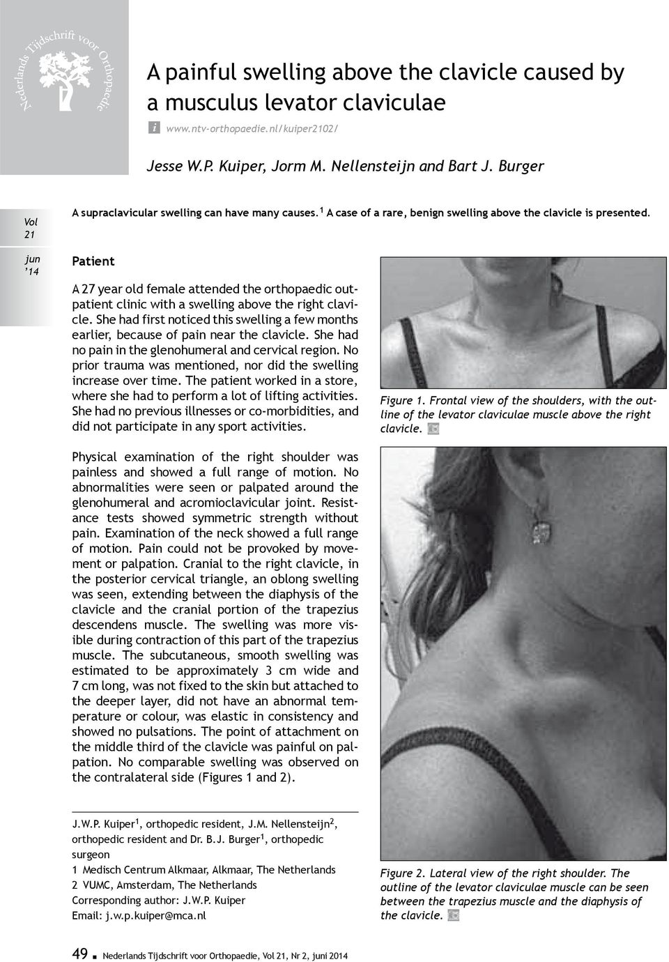 Patient A 27 year old female attended the orthopaedic outpatient clinic with a swelling above the right clavicle.