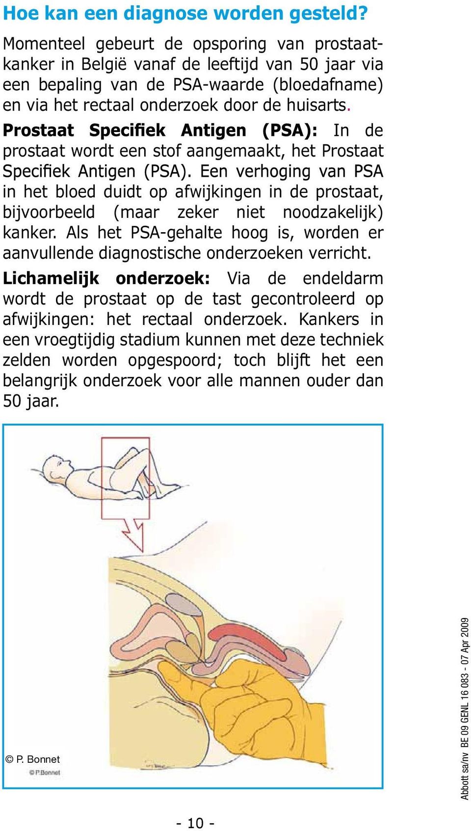 In de prostaat wordt een stof aangemaakt, het Prostaat in het bloed duidt op afwijkingen in de prostaat, bijvoorbeeld (maar zeker niet noodzakelijk) kanker.