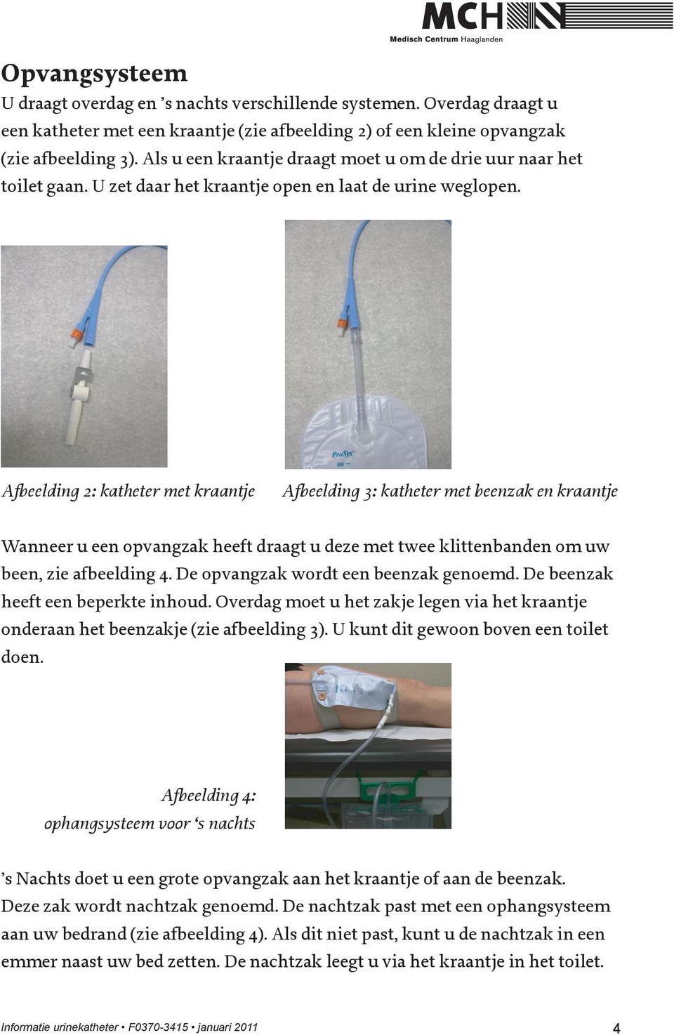 Afbeelding 2: katheter met kraantje Afbeelding 3: katheter met beenzak en kraantje Wanneer u een opvangzak heeft draagt u deze met twee klittenbanden om uw been, zie afbeelding 4.
