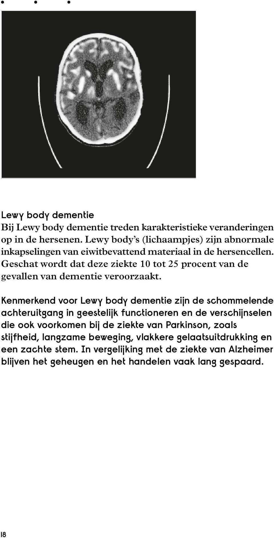 Geschat wordt dat deze ziekte 10 tot 25 procent van de gevallen van dementie veroorzaakt.