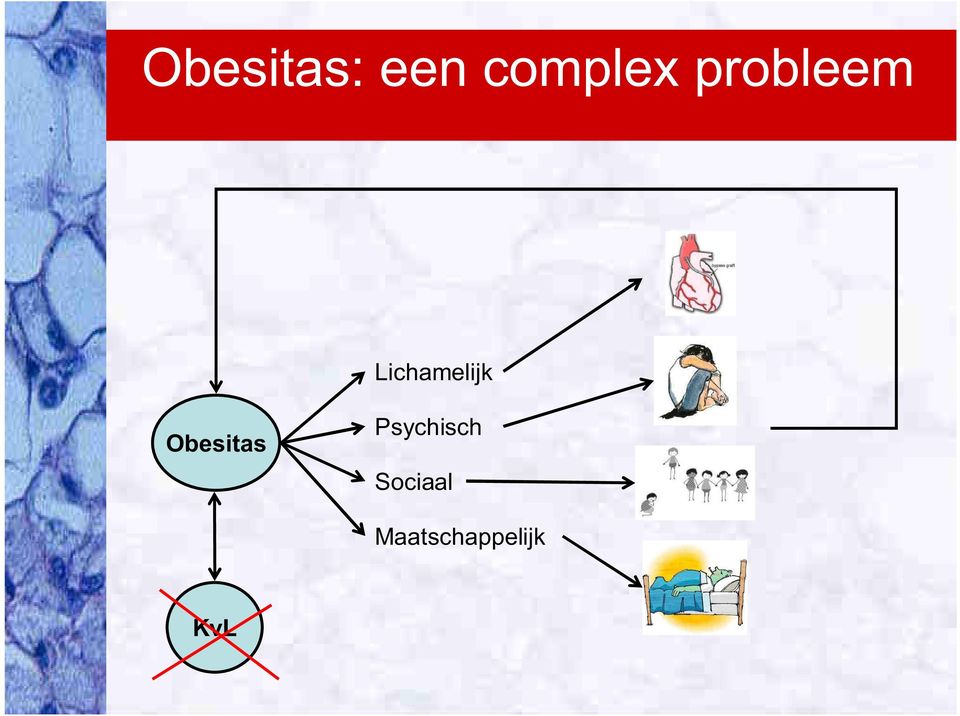 Obesitas Psychisch