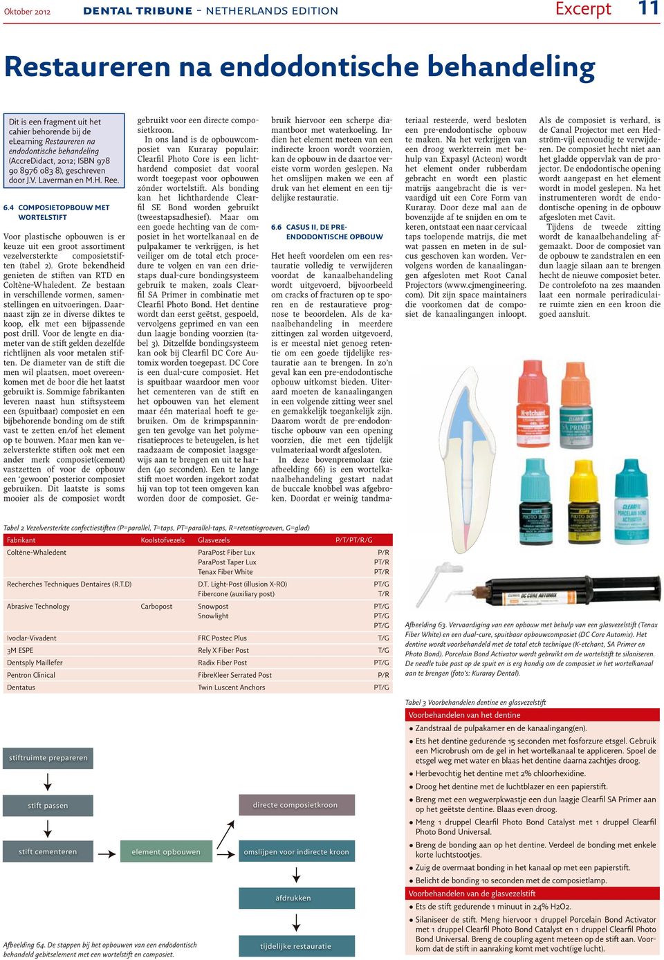 4 COMPOSIETOPBOUW MET WORTELSTIFT Voor plastische opbouwen is er keuze uit een groot assortiment vezelversterkte composietstiften (tabel 2).