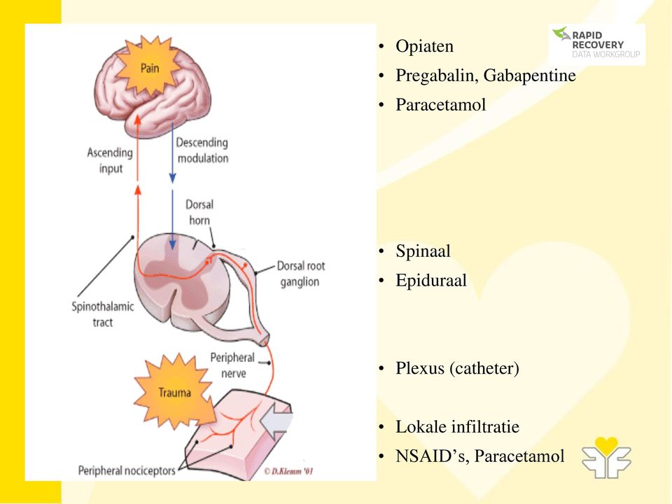 Spinaal Epiduraal Plexus