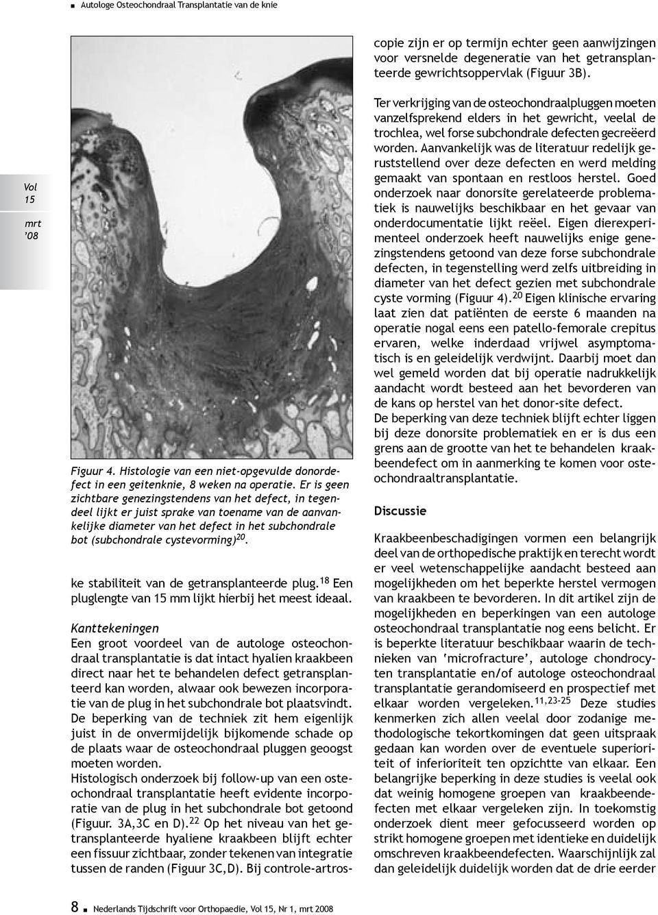 De beperking van de techniek zit hem eigenlijk juist in de onvermijdelijk bijkomende schade op de plaats waar de osteochondraal pluggen geoogst moeten worden.