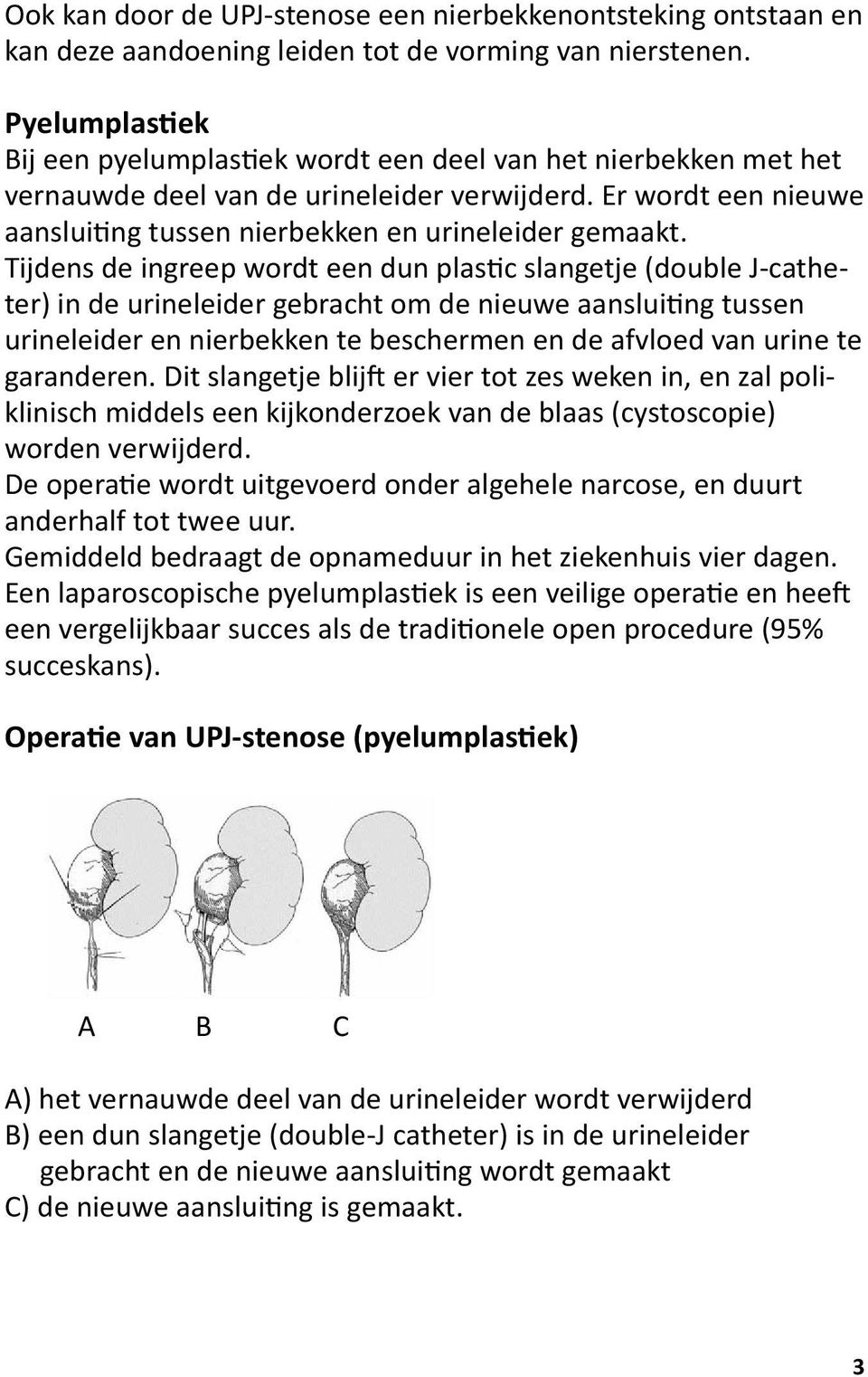 Tijdens de ingreep wordt een dun plastic slangetje (double J-catheter) in de urineleider gebracht om de nieuwe aansluiting tussen urineleider en nierbekken te beschermen en de afvloed van urine te