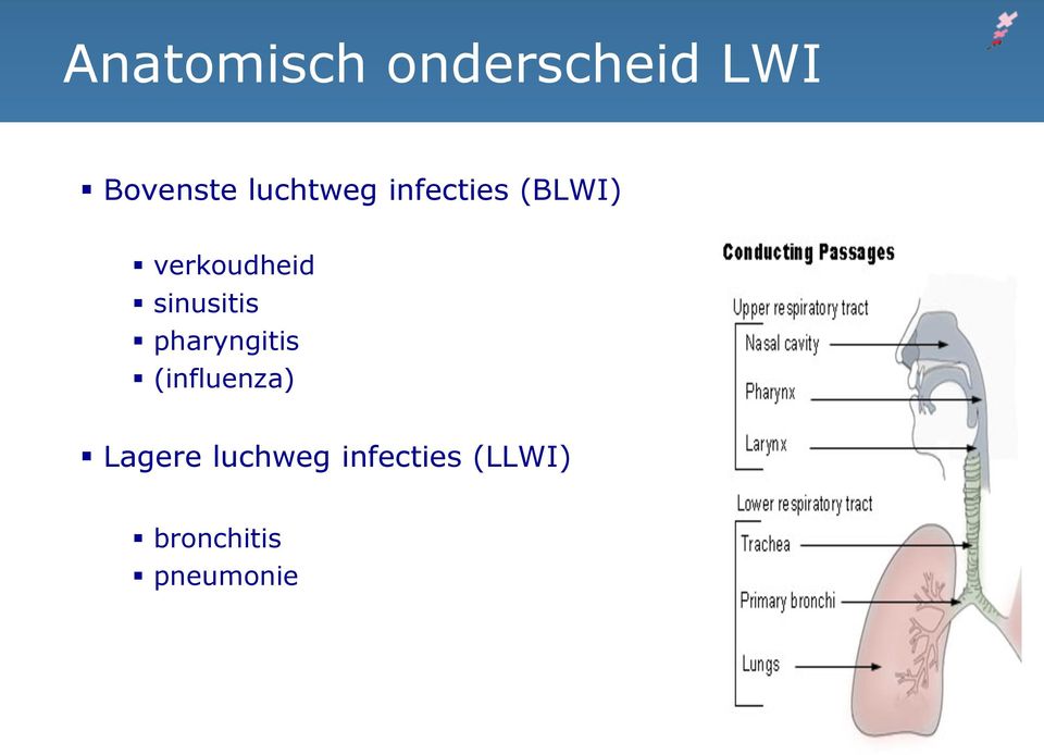 sinusitis pharyngitis (influenza)