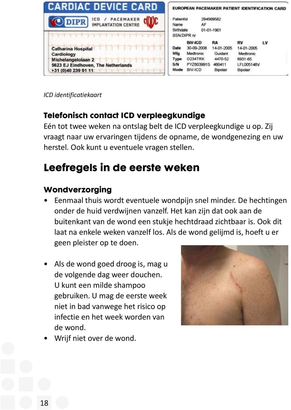 Leefregels in de eerste weken Wondverzorging Eenmaal thuis wordt eventuele wondpijn snel minder. De hechtingen onder de huid verdwijnen vanzelf.