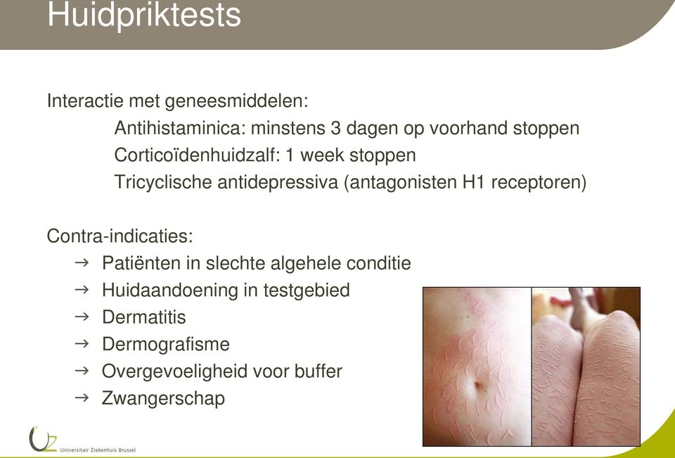 (antagonisten H1 receptoren) Contra-indicaties: Patiënten in slechte algehele conditie