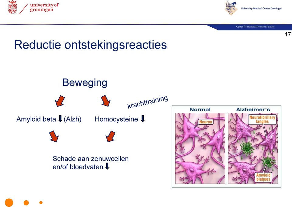 Amyloid beta (Alzh)